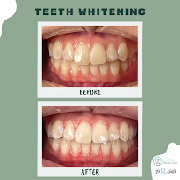 SmileGram Dental Clinic PJ (Petaling Jaya)