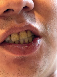 Primecare Dental Clinic - Damansara Uptown 佳護牙科診所