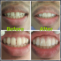 Quality Dental Care - Dental Clinic in Petaling Jaya
