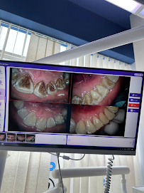 Ocean Dental Clinic (Ara Damansara)