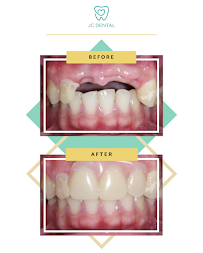 JC Dental Clinic