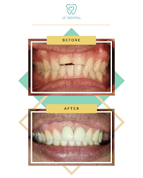 JC Dental Clinic