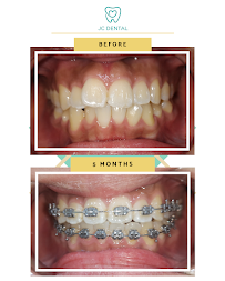 JC Dental Clinic
