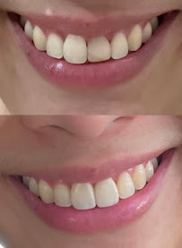 ESTE dental clinic (คลินิกทันตกรรมเอสเต้ พัทยา)