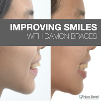 Nova Dental Clinic