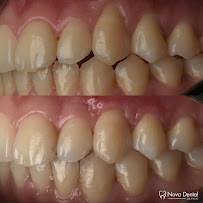Nova Dental Clinic