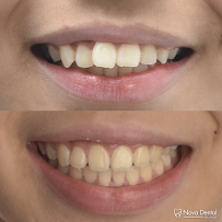 Nova Dental Clinic