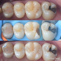Nova Dental Clinic