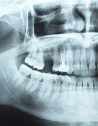 DING DENTAL CLINIC TROPICANA AVENUE (INVISALIGN PROVIDER,隐适美矫正)