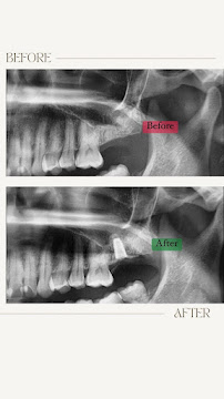 IVORY Dental at Atria Shopping Gallery by Icare Dental