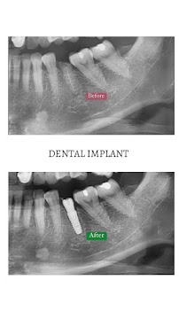 IVORY Dental at Atria Shopping Gallery by Icare Dental