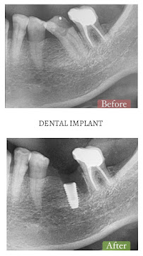 IVORY Dental at Atria Shopping Gallery by Icare Dental