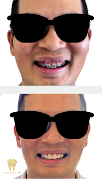 Classé Dental care