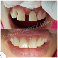 Pinky dental clinic (สาขาตลาดไร่วนาสินธุ์)