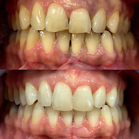 Clínica Dental Garriga - Dentista en Eixample Barcelona