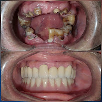 Clínica Dental Garriga - Dentista en Eixample Barcelona