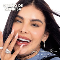 DENTAL & DESIGN GROUP - Expertos en Diseños de Sonrisa, Carillas Dentales - Barcelona