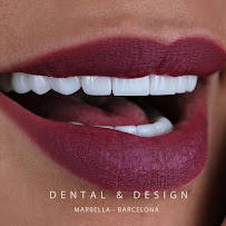 DENTAL & DESIGN GROUP - Expertos en Diseños de Sonrisa, Carillas Dentales - Barcelona