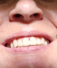 Clínica Dental Bucalia Barcelona Aribau