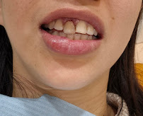 Clinica Dental Caser Barcelona - Diagonal