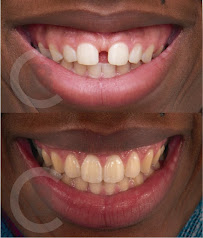 BLASI Clínica Dental Barcelona