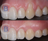 BLASI Clínica Dental Barcelona