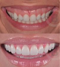 BLASI Clínica Dental Barcelona