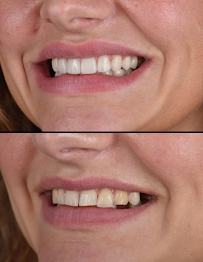 Clínica Dental Puyuelo: Dentistas en Barcelona