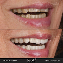 Clínica Dental Puyuelo: Dentistas en Barcelona