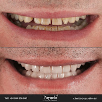 Clínica Dental Puyuelo: Dentistas en Barcelona