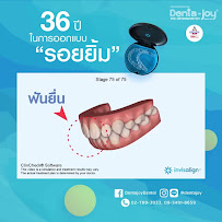Dentajoy Pattaya (เดนต้าจอย สาขาพัทยา) จัดฟันใส Invisalign จัดฟัน Brava วีเนียร์ รากเทียม