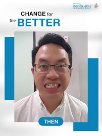 Dentajoy Pattaya (เดนต้าจอย สาขาพัทยา) จัดฟันใส Invisalign จัดฟัน Brava วีเนียร์ รากเทียม