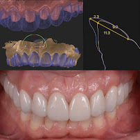 Clínica Dental DEN Barcelona