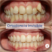 Dental Clinic Barcelona - Dentist Cleardent