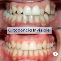 Dental Clinic Barcelona - Dentist Cleardent