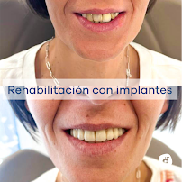 Dental Clinic Barcelona - Dentist Cleardent