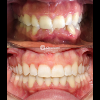 Dental Clinic Barcelona - Dentist Cleardent