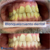 Dental Clinic Barcelona - Dentist Cleardent