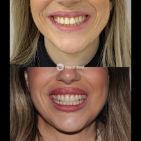 Dental Clinic Barcelona - Dentist Cleardent