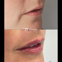 Dental Clinic Barcelona - Dentist Cleardent