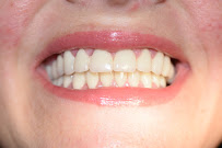 Clínica Dental Diente Sano