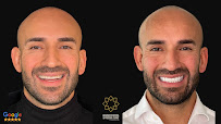 Advanced Dental & Medical Clinic · Implantes, Carillas, Alineadores Invisalign · English & Russian spoken