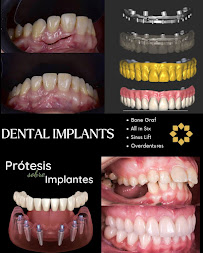 Advanced Dental & Medical Clinic · Implantes, Carillas, Alineadores Invisalign · English & Russian spoken