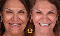 Advanced Dental & Medical Clinic · Implantes, Carillas, Alineadores Invisalign · English & Russian spoken