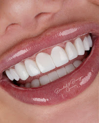 DENTAL & DESIGN GROUP - Expertos en Diseños de Sonrisa, Carillas Dentales - Madrid