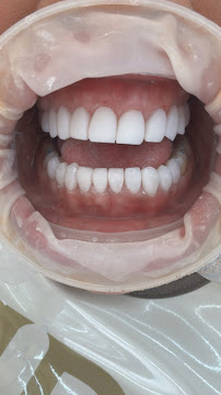DENTAL & DESIGN GROUP - Expertos en Diseños de Sonrisa, Carillas Dentales - Madrid