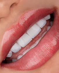 DENTAL & DESIGN GROUP - Expertos en Diseños de Sonrisa, Carillas Dentales - Madrid