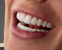 DENTAL & DESIGN GROUP - Expertos en Diseños de Sonrisa, Carillas Dentales - Madrid