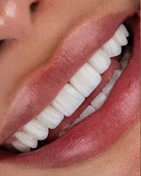 DENTAL & DESIGN GROUP - Expertos en Diseños de Sonrisa, Carillas Dentales - Madrid