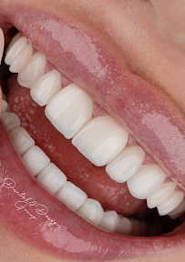 DENTAL & DESIGN GROUP - Expertos en Diseños de Sonrisa, Carillas Dentales - Madrid